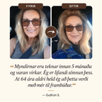 Tímalaus orkublanda
